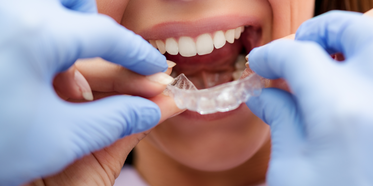 Tipos de ortodoncia invisible: ¿cuál es la mejor opción para nuestra sonrisa?